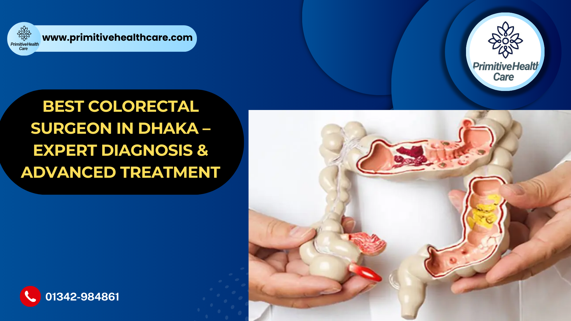 Best Colorectal Surgeon in Dhaka – Expert Diagnosis & Advanced Treatment